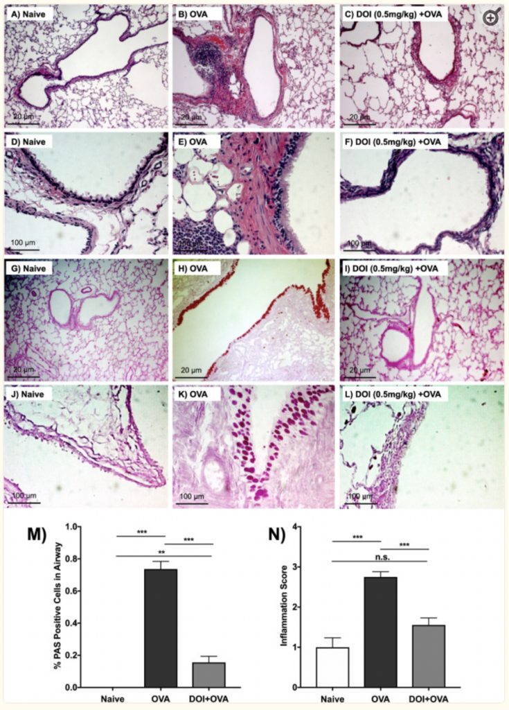 Scans of rat lungs showing how 2-CH can prevent inflammation and mucus overproduction. 